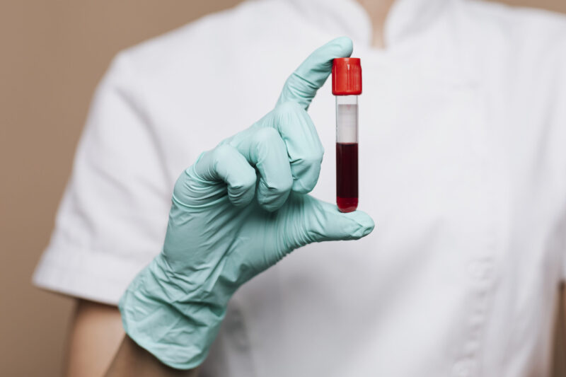 prelievo di sangue