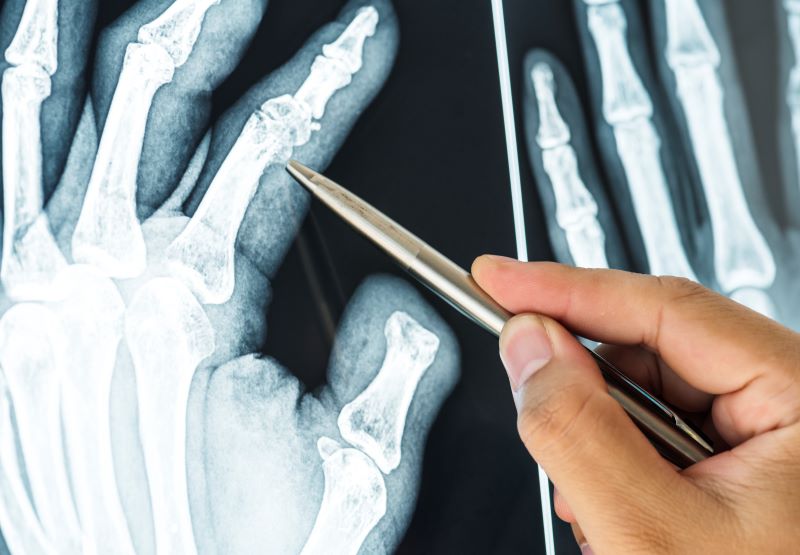 Radiografie di controllo