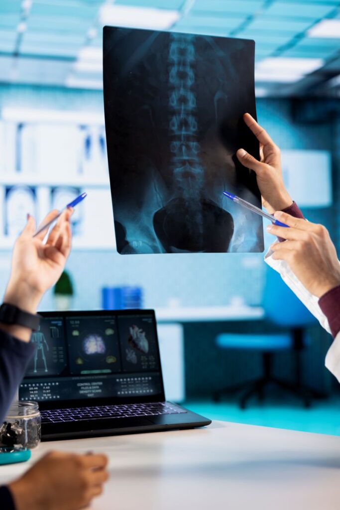 Radiografie di controllo