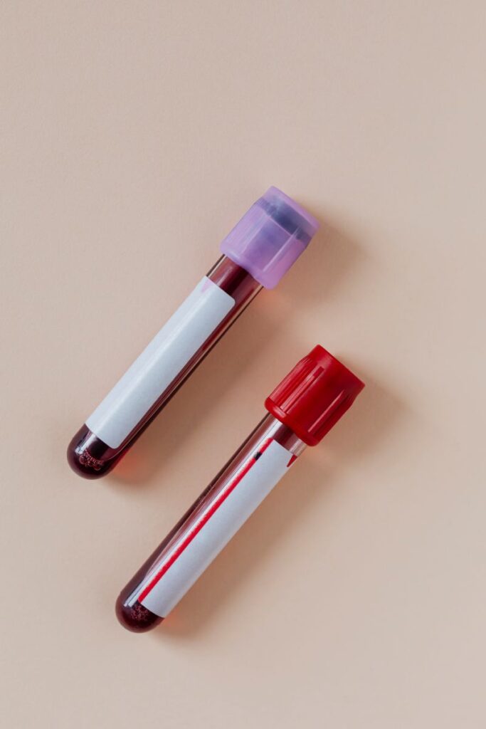 Esami del Sangue