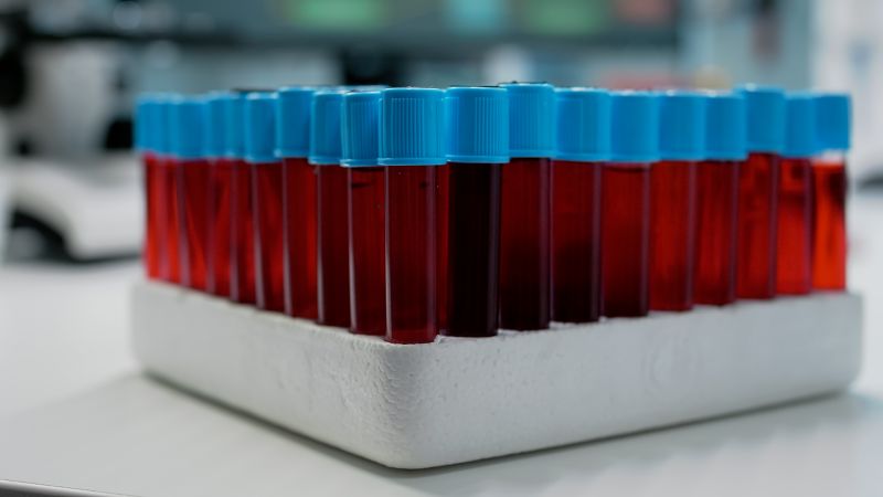 Valore fuori range